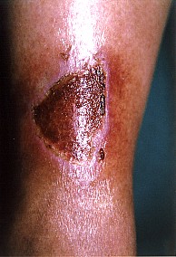 Porous Regenerative Membrane
